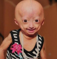 Adalia Rose