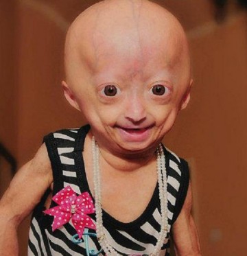 Adalia Rose