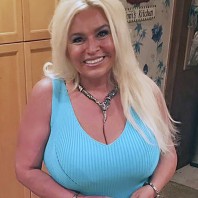 Beth Chapman